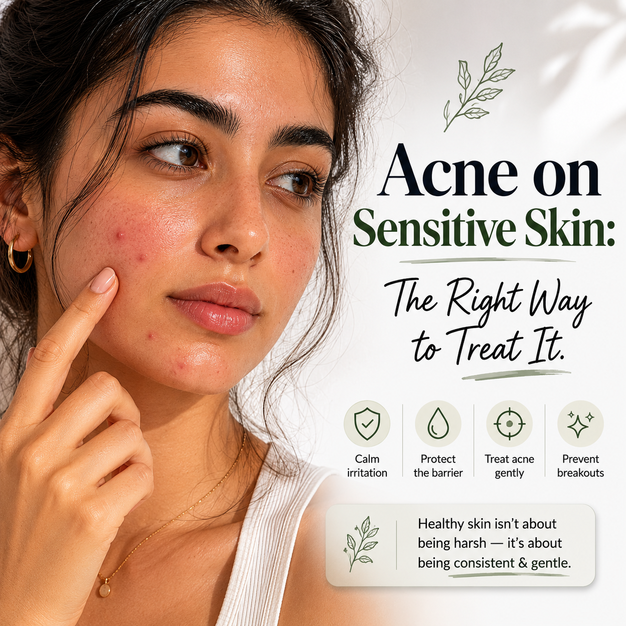 Acne on Sensitive Skin: A Step-by-Step Guide to Treating It With the Right Routine