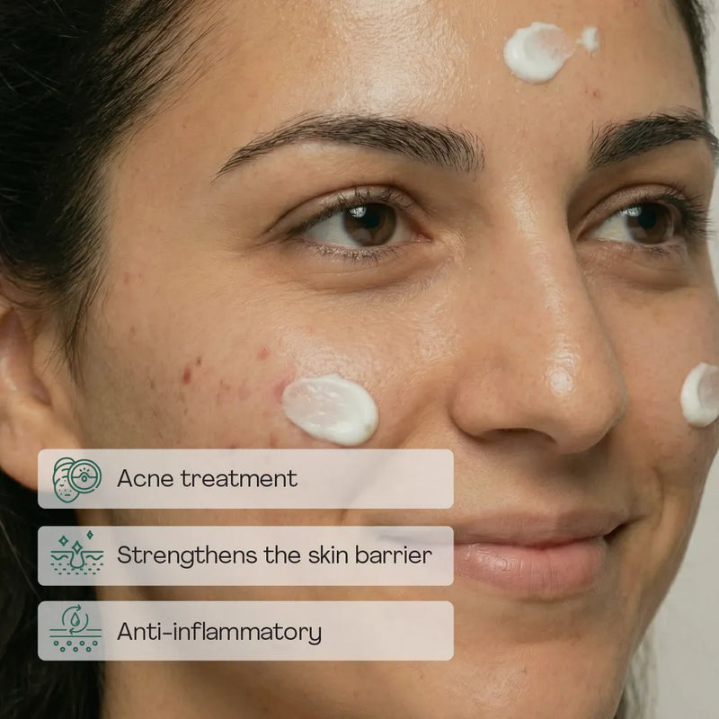 Acne-Prone Skin Treatment Cream 60ml