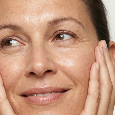 Fine Lines, Wrinkles & Aging